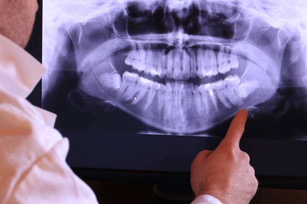 Best Emergency Tooth Extraction in Horizon City, TX